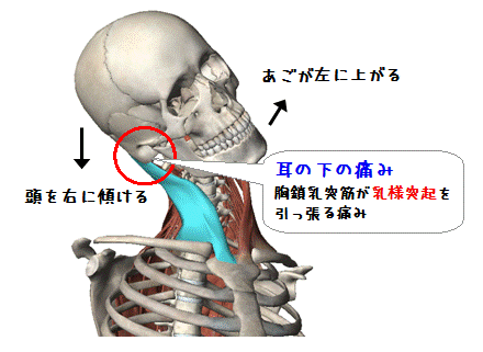 首を動かす耳の下の痛み（図解）