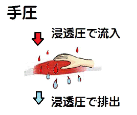 手圧の逆浸透圧（図解）