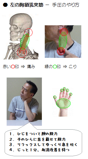 胸鎖乳突筋の手圧のやり方（図解）