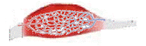 筋肉の毛細血管のイメージ