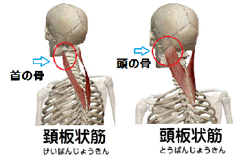 頚板状筋・頭板状筋の解剖図